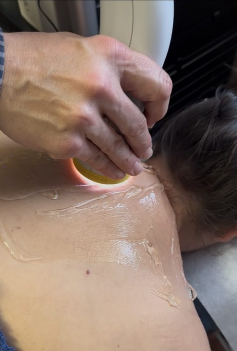 SoftWave therapy applicator delivering broad-focused shockwaves to a patient's neck and upper back at Hansen Chiropractic