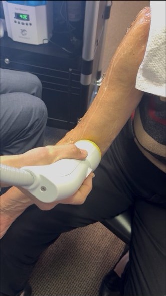 SoftWave therapy treatment for elbow and joint pain
